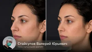 Рекламный креатив в Telegram Ads