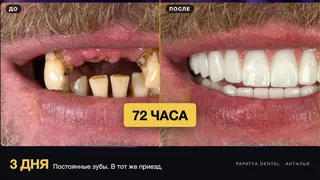 Creatividad publicitaria en Telegram Ads