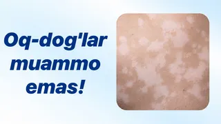 Рекламный креатив в Telegram Ads @qomus_salomatlik_bot
