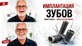 Рекламный креатив в Telegram Ads