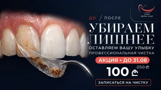 Рекламный креатив в Telegram Ads