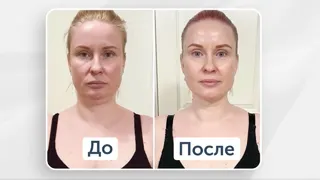 Рекламный креатив в Telegram Ads